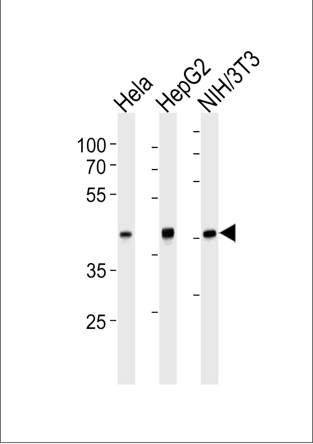 Monoclonal Mouse anti-Human TBP / GTF2D Antibody (clone 830CT4.3.3, WB)