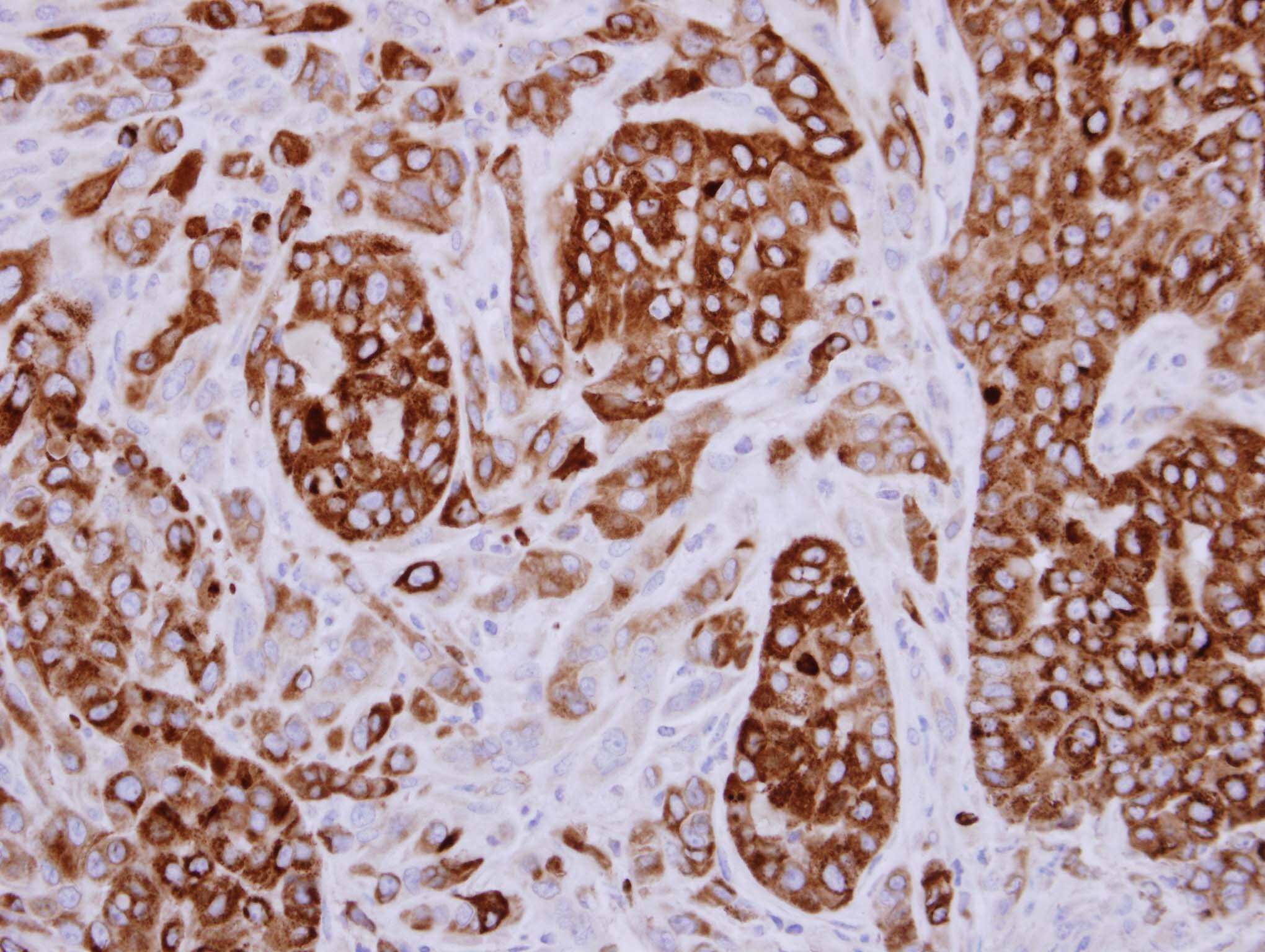 AG3 / AGR3 Antibody (aa1-166)