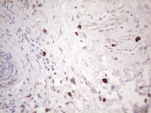 c-Kit / CD117 Antibody (aa27-308, clone OTI1B6, Carrier-free)