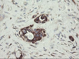 TPD52L3 Antibody (clone OTI8C12)