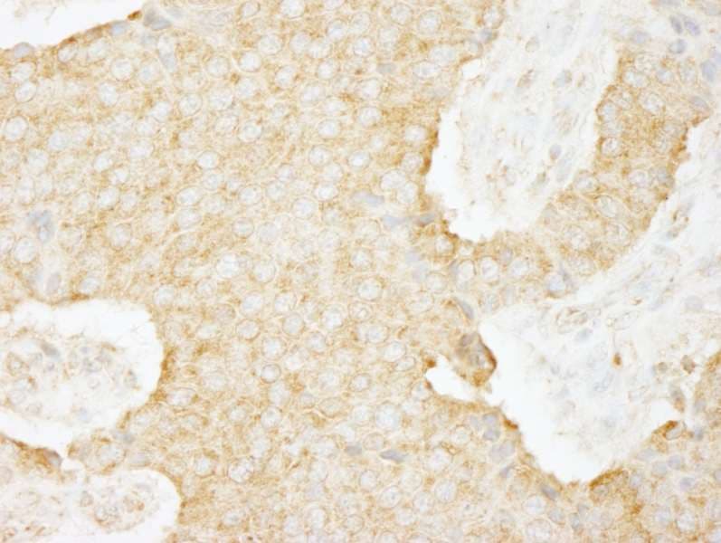USP3 / UBP Antibody (aa471-521)