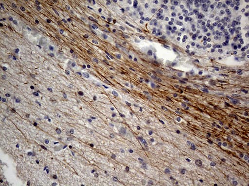 NEFH / NF-H Antibody (aa778-1020, clone OTI10A7)