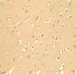 Polyclonal Rabbit anti-Human LY96 / MD2 / MD-2 Antibody (IHC, WB)