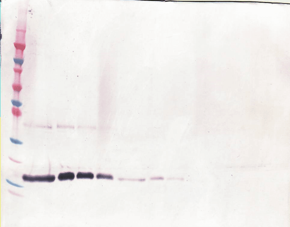 Polyclonal Rabbit anti-Human CSF1 / MCSF Antibody (WB)