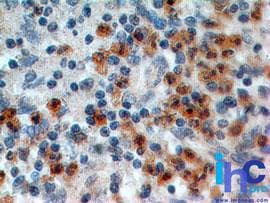 IL17RA Antibody (aa186-267, clone 49M4D2)