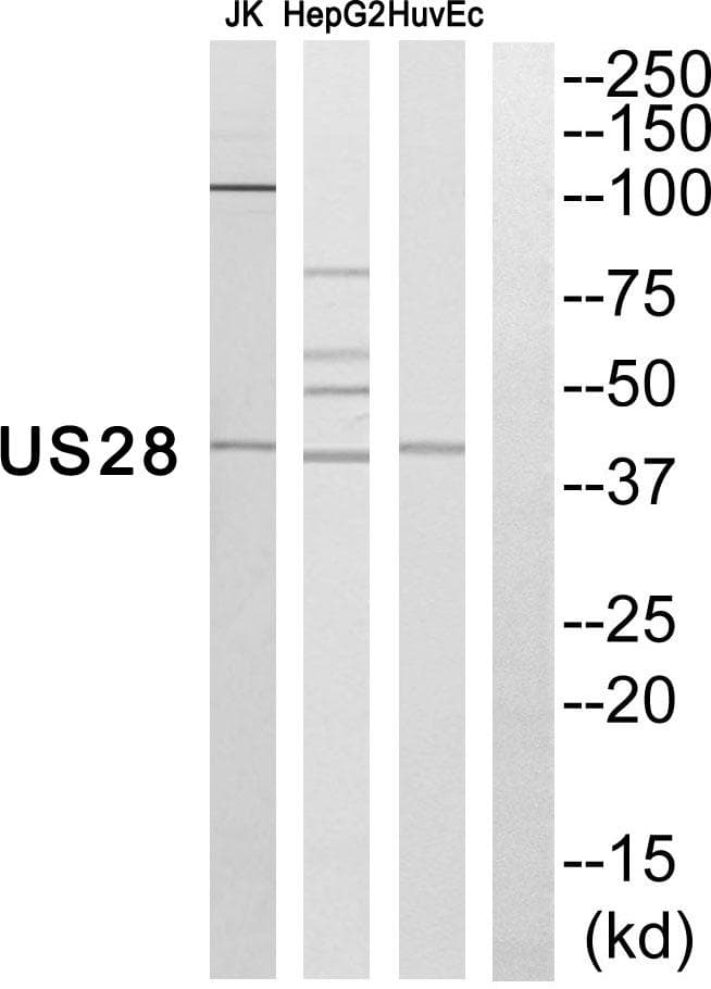 G Protein-coupled Receptor US28 (HHRF3) [Cytomegalovirus] Antibody