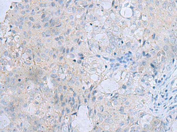 MSI2 Antibody