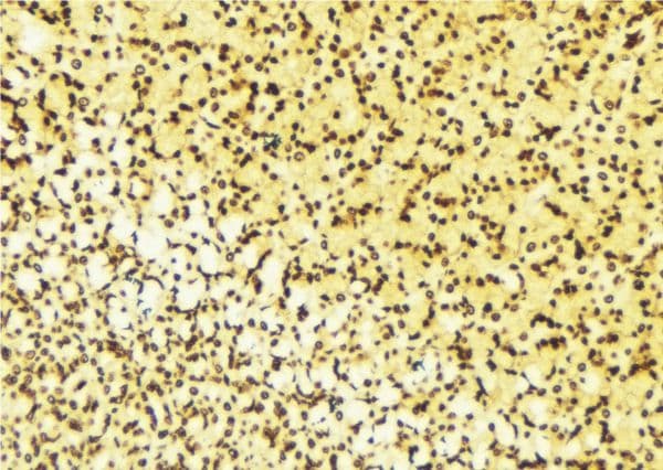 NET1 / ARHGEF8 Antibody