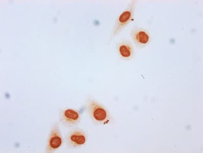 Polyclonal Rabbit anti-Human HIST1H3A Antibody (IHC, WB)