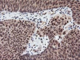 TP53 / p53 Antibody (clone OTI2H6, Carrier-free)