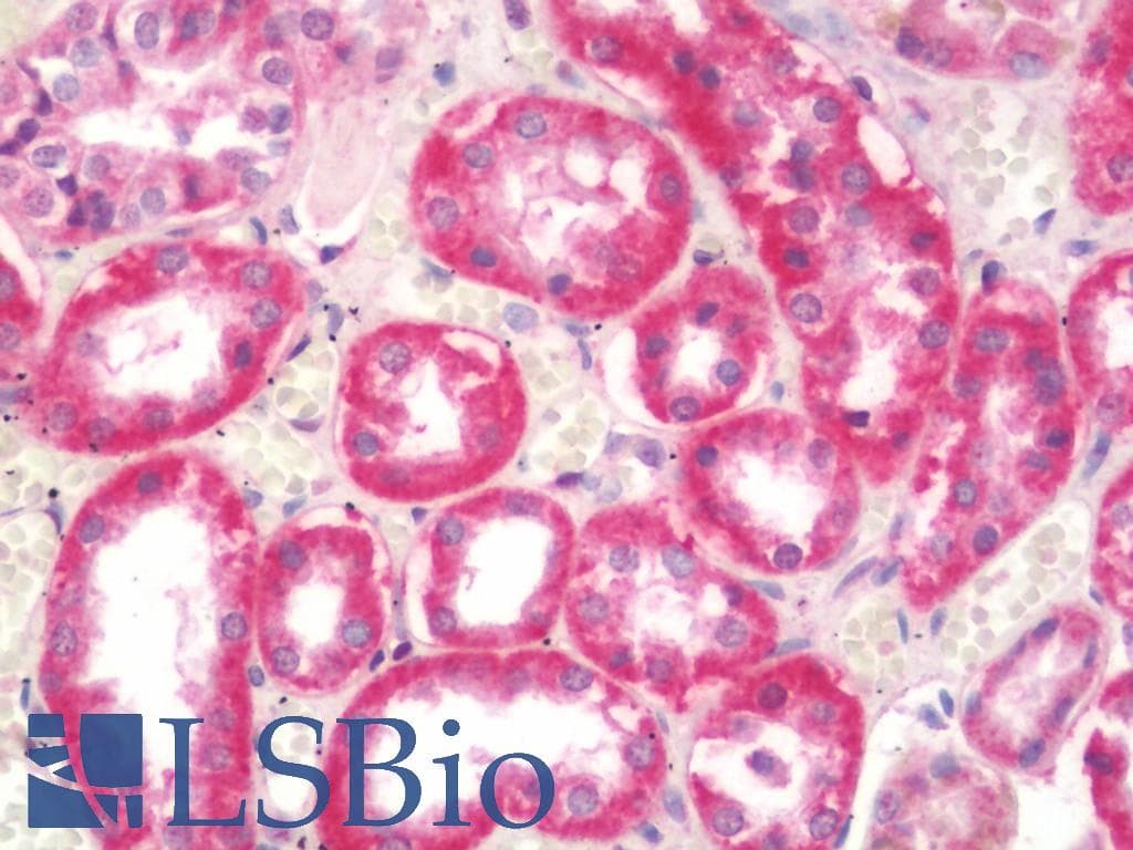 IHC-plus™ Polyclonal Rabbit anti-Human ODZ3 Antibody (IHC, IF, WB)