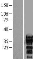 ZCCHC17 / PNO40 / PS1D Protein (Over-Expression Lysate Myc-DDK (Flag))