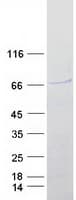 Human SOX4 Protein (Recombinant Myc-DDK (Flag))