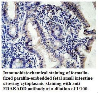 Polyclonal Rabbit anti-Human EDARADD Antibody (aa1-127, IHC, WB)
