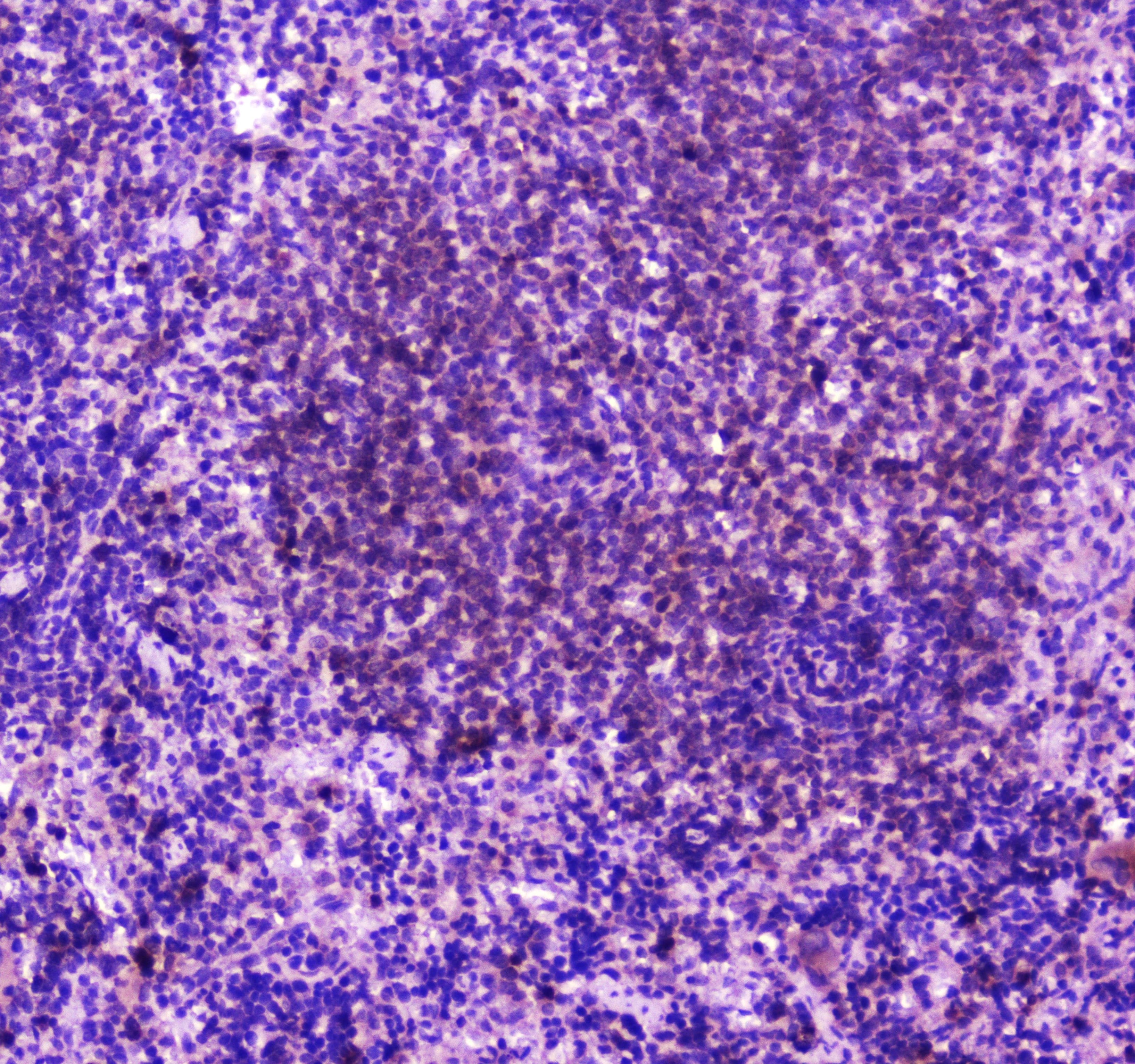 PLCG2 / PLC Gamma 2 Antibody