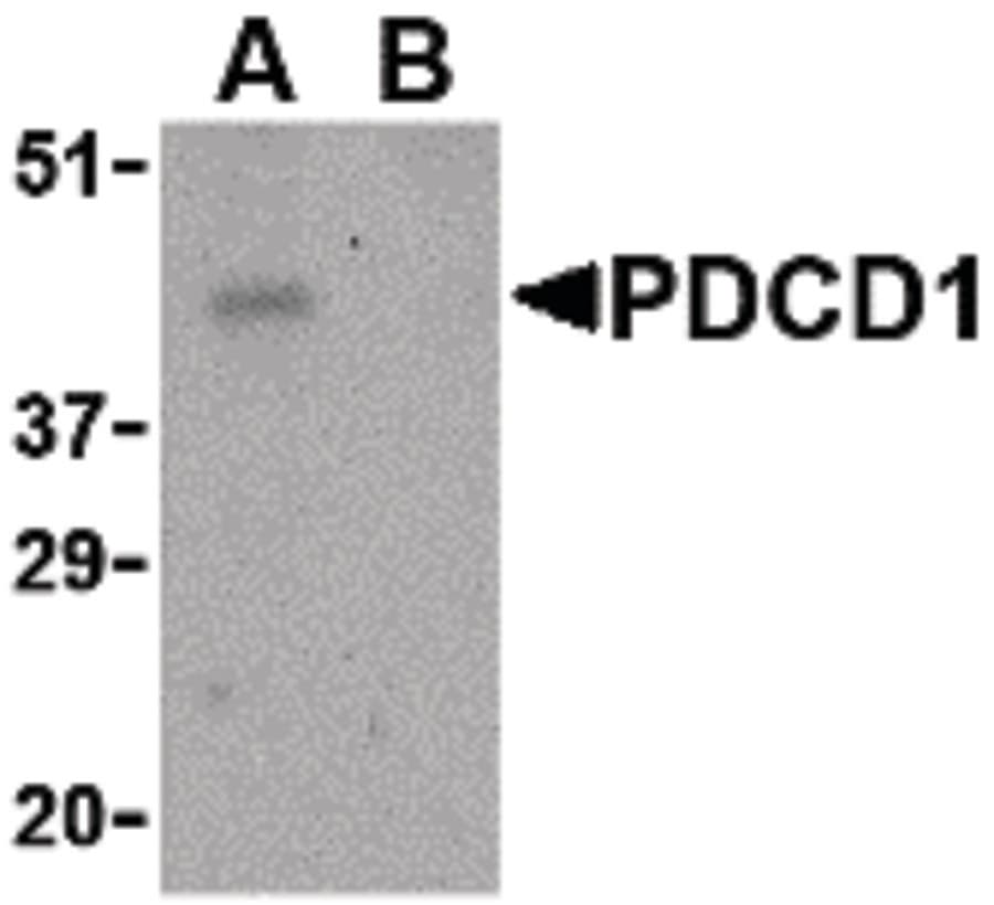 IHC-plus™ PDCD1 / CD279 / PD-1 Antibody