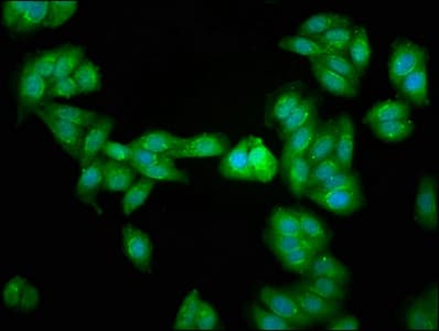 Polyclonal Rabbit anti-Human PDCD10 Antibody (aa1-212)