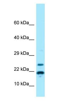 RPS11 / Ribosomal Protein 11 Antibody (N-Terminus)