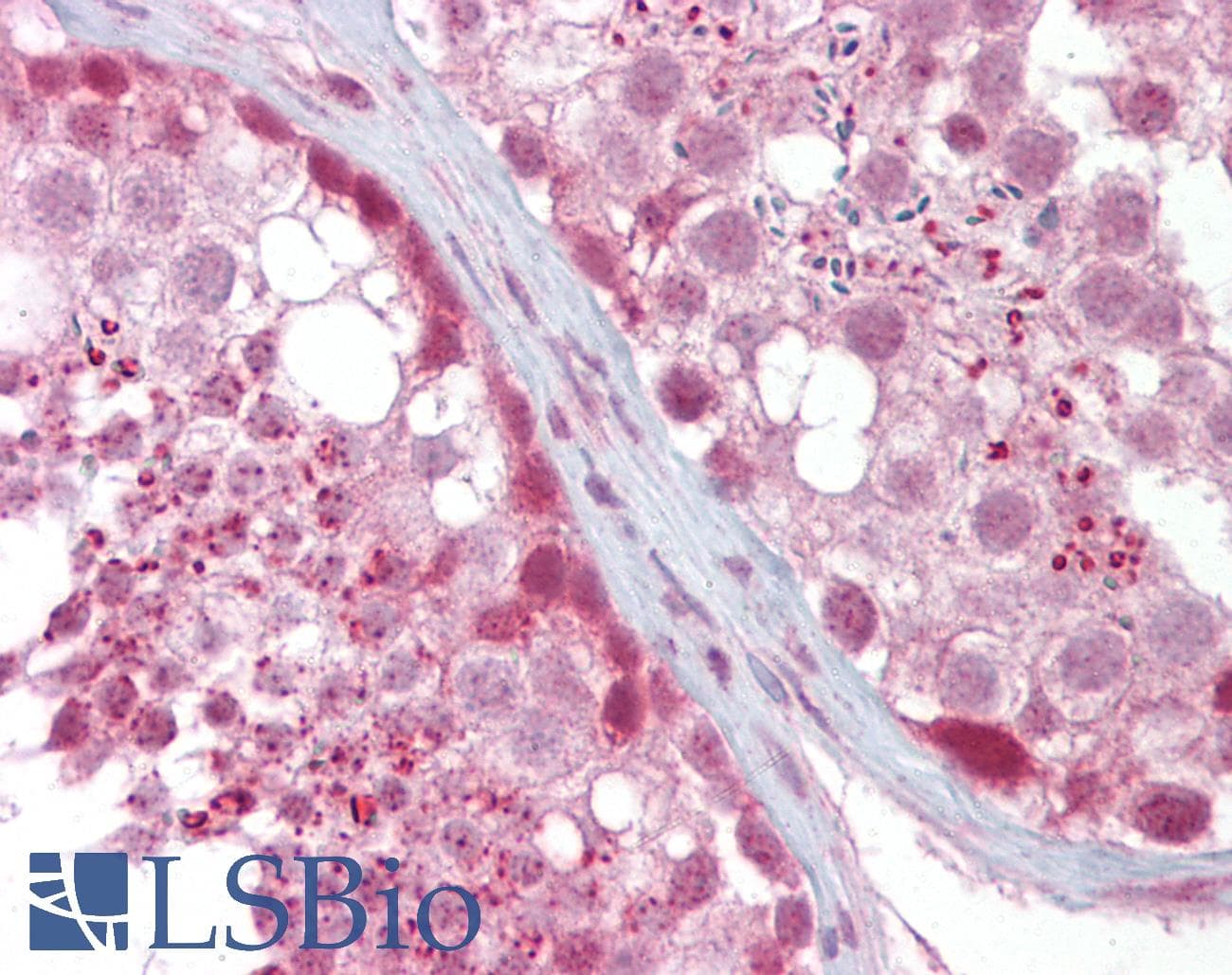 Polyclonal Rabbit anti-Human TG737 / IFT88 Antibody (aa721-770, IHC, WB)