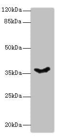 Polyclonal Rabbit anti-Human PSG11 Antibody (WB)