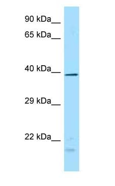 Polyclonal Rabbit anti-Human DUSP4 / MKP2 Antibody (aa76-125, WB)