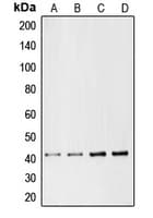 IHC-plus™ Polyclonal Rabbit anti-Human CHEMR23 / CMKLR1 Antibody (Internal, IHC, WB)