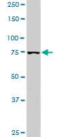 PIK3R1 / p85 Alpha Antibody (clone 3C11)