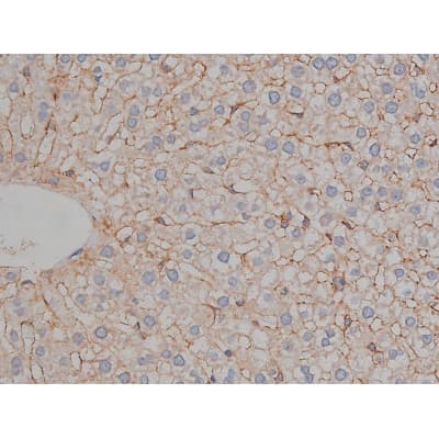 MAPT / Tau Antibody (phospho-Ser404)