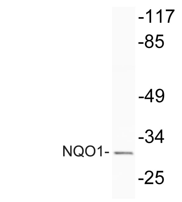 Polyclonal Rabbit anti-Human NQO1 Antibody (aa203-252, WB)