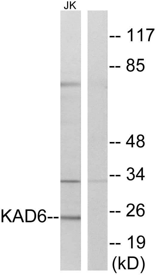 AK6 / Adenylate Kinase 6 Antibody (aa11-60)