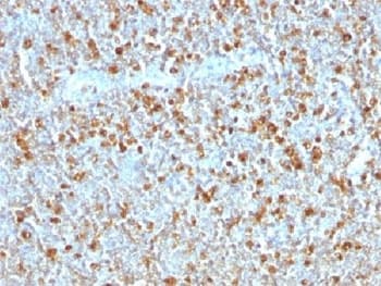 SERPINA1 / Alpha 1 Antitrypsin Antibody (clone AAT/1379)