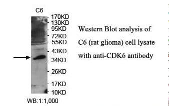 Polyclonal Rabbit anti-Human CDK6 Antibody (aa155-301, IHC, WB)