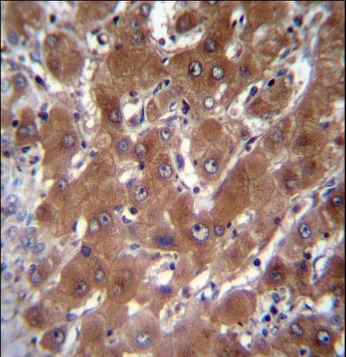 GBA3 / CBG Antibody (aa296-325)
