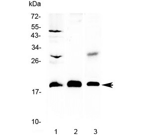 TMEM240 / C1orf70 Antibody