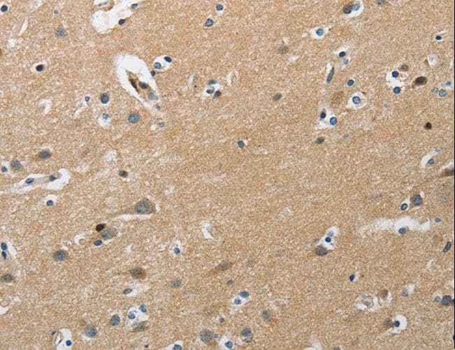 PIP5K1C Antibody