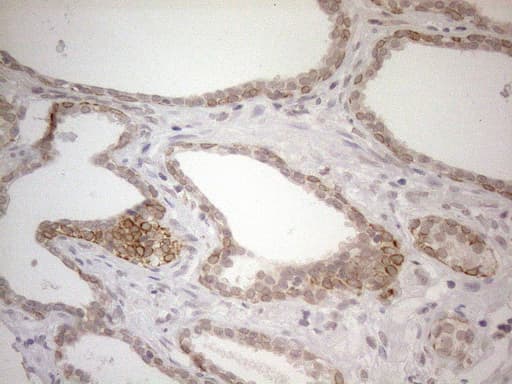 PD-L2 / PDCD1LG2 / CD273 Antibody (clone UMAB223, Carrier-free)