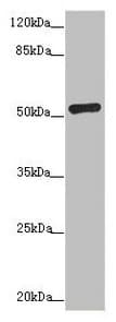 Polyclonal Rabbit anti-Human ADPGK Antibody (IHC, WB)