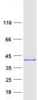 Human HSDL1 Protein (Recombinant Myc-DDK (Flag))