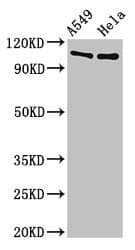 Polyclonal Rabbit anti-Human EML4 Antibody (WB)
