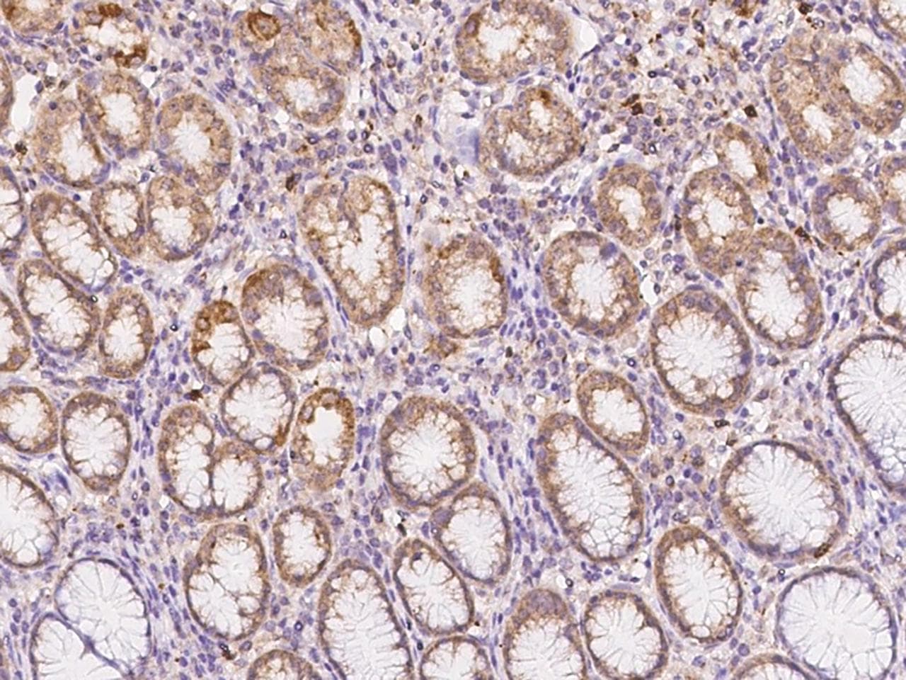 Polyclonal Rabbit anti-Human NXNL2 Antibody (IHC)
