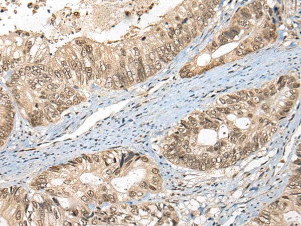 FUT4 / CD15 Antibody