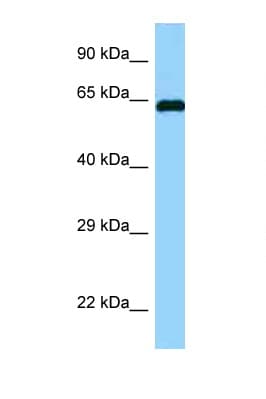 ABI1 / SSH3BP1 Antibody (aa122-171)