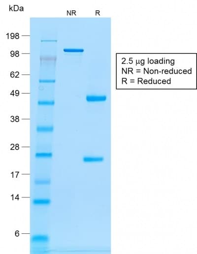 PathPlus™ CD20 Antibody (clone rIGEL/773)