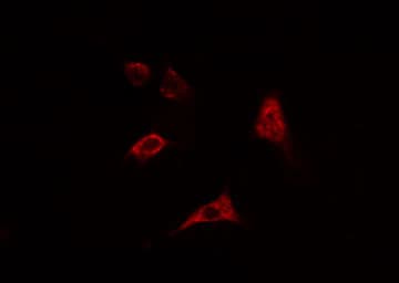 CHKB / CHKL Antibody
