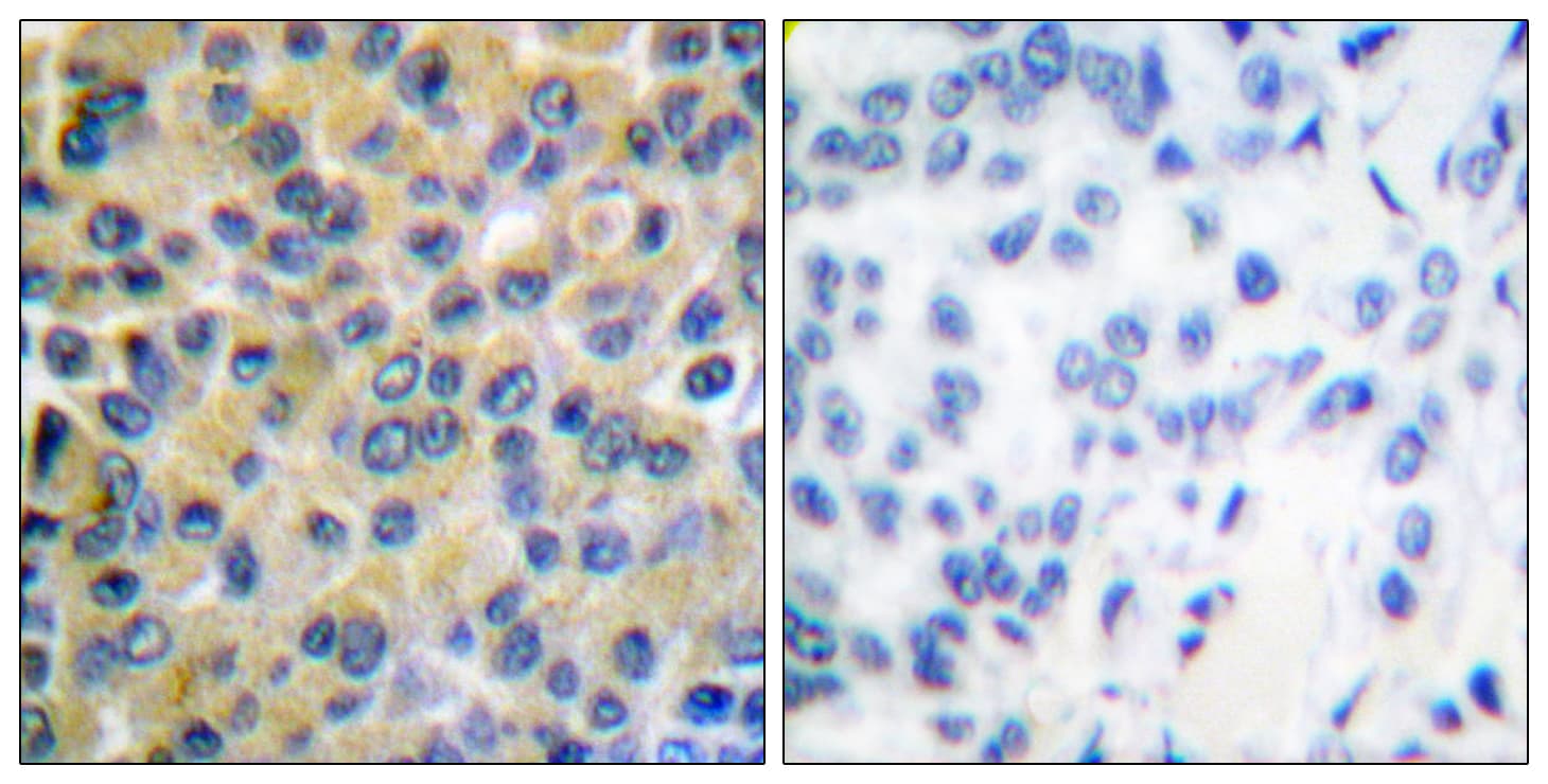 PTPN11 / SHP-2 / NS1 Antibody (aa546-595)