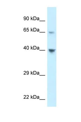 ACKR4 / CCRL1 / CCR11 Antibody (C-Terminus)