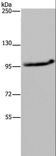 Polyclonal Rabbit anti-Human MAP3K11 / MLK3 Antibody (IHC, WB)