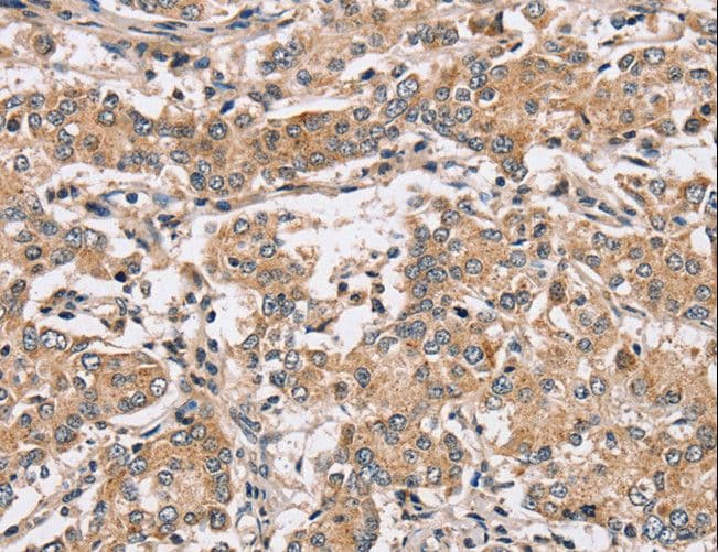 PPP1CC / PP1 Gamma Antibody