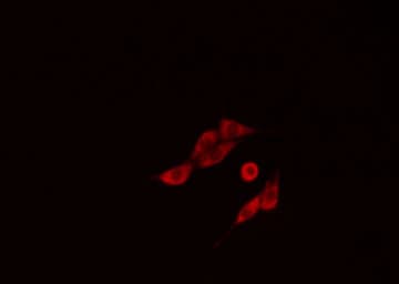 NCBP2 / CBP20 Antibody
