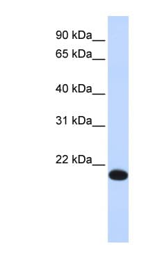 YAF2 Antibody (aa72-121)
